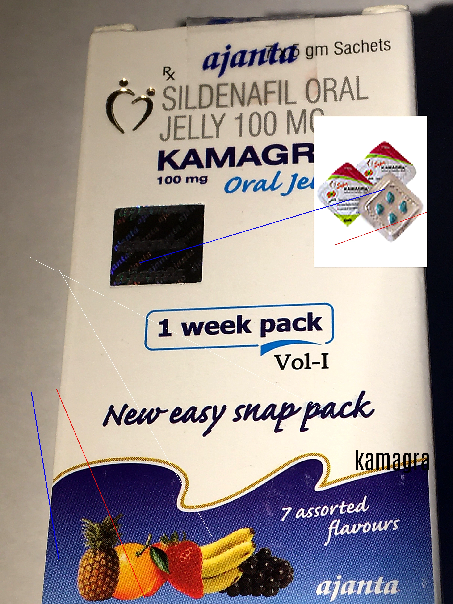 Doctissimo achat kamagra